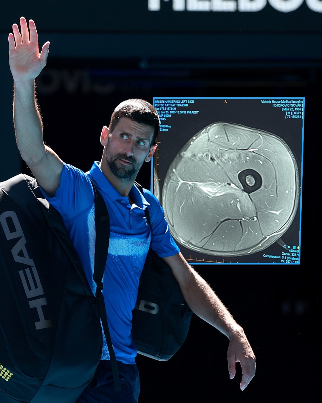 包含ATP总决赛翻盘戴维斯杯，德约科维奇刷新纪录的词条